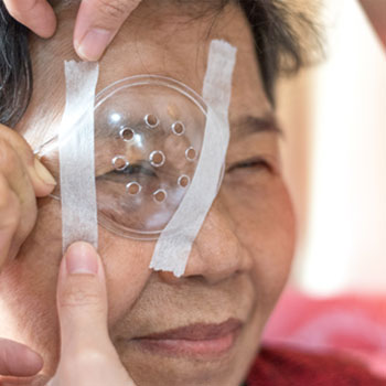 Cataract Surgery